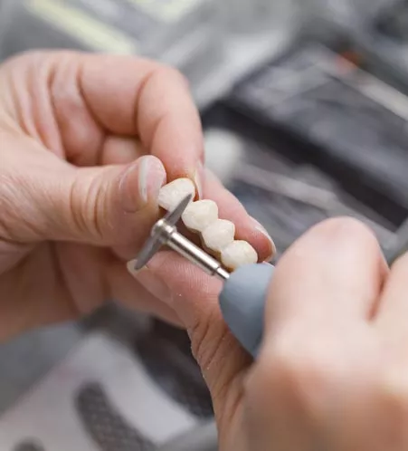 Technician working on dental bridge